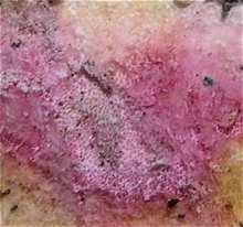 Hypomyces rosellus MykoGolfer
